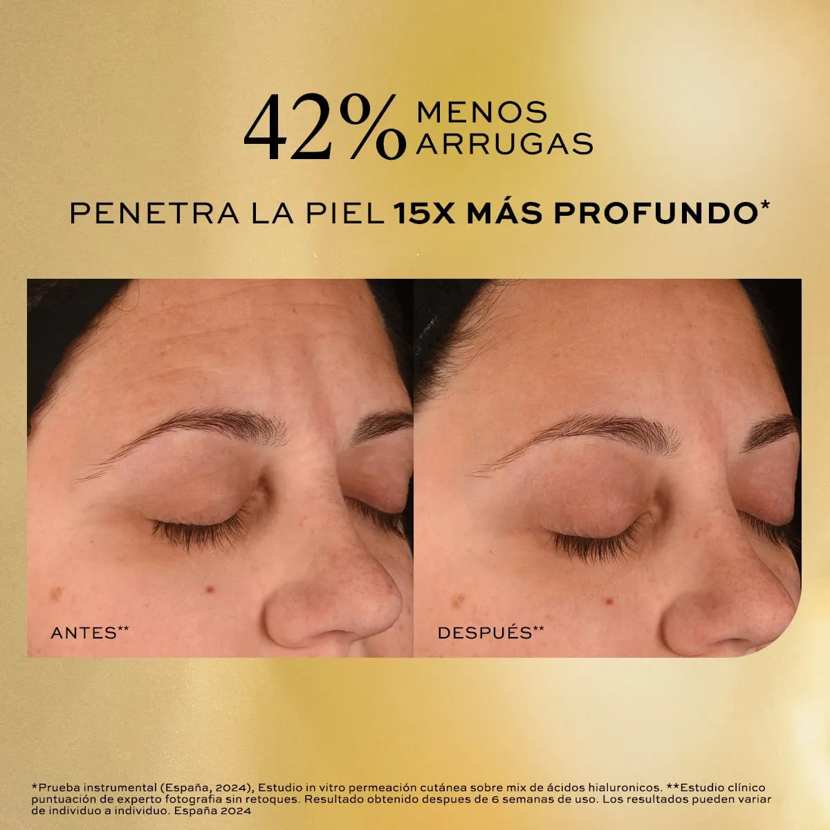 Serum Ácido Hialurónico Concentré Reductor de Arrugas