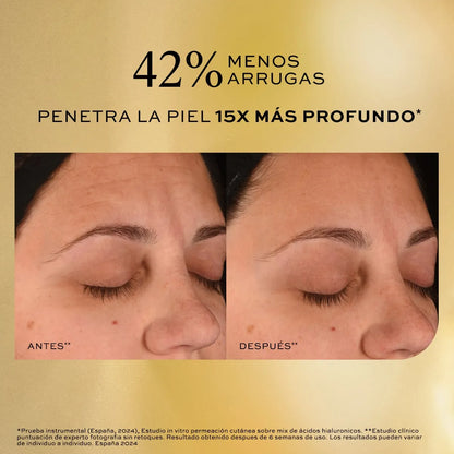 Serum Ácido Hialurónico Concentré Reductor de Arrugas